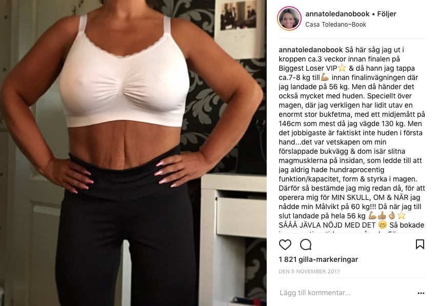 operera magen gå ner i vikt operera magen gå ner i vikt