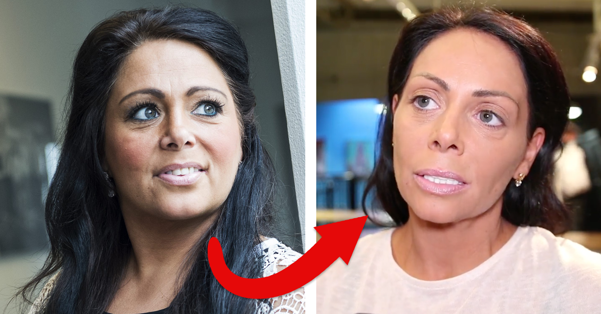 Anna Book avslöjar: Så mycket kostade mitt nya utseende